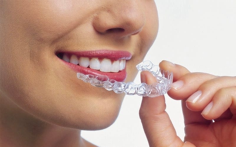are aligner painful