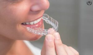 MK Aligners Kullaniminda Yasanan Yaygin Sorunlar