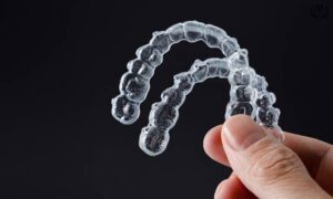 MK Aligners Tedavisinde Beslenme Tavsiyeleri