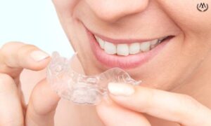 MK Aligners Tedavisinin Avantajlari ve Dezavantajlari