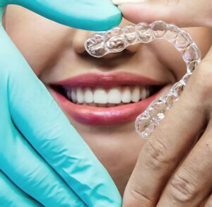 MK Aligners Tedavisi Kimler Icin Uygun Degildir