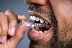 MK Aligners Tedavisinde Agri ve Rahatsizlik Neler Yapilabilir