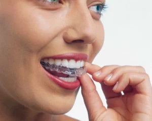 MK Aligners Tedavisinde Dis Eti Sagligini Koruma Ipuclari