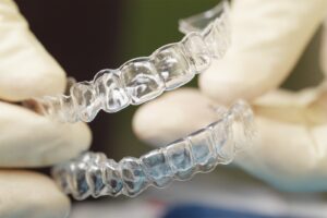 MK Aligners ile Geleneksel Dis Telleri Arasindaki Farklar