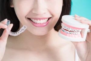 MK Aligners ile Konusma Problemleri Nasil Asilir