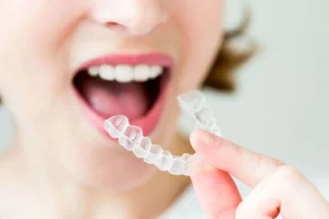 MK Aligners ile Tedavi Oncesi Bilinmesi Gerekenler