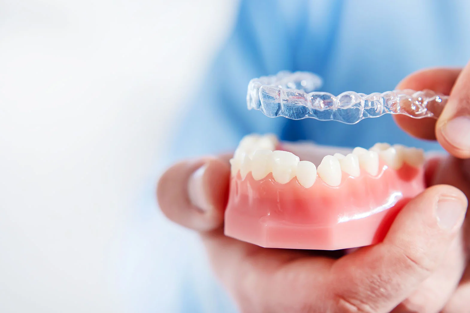 What Are Attachments and IPR in Clear Aligner Treatment? 1 Seffaf Plaklarin Omru Ne Kadar
